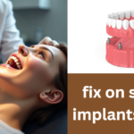 fix on six mini implants erie pa